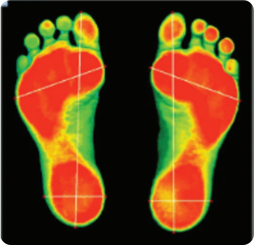 Editar Puntos de Representación