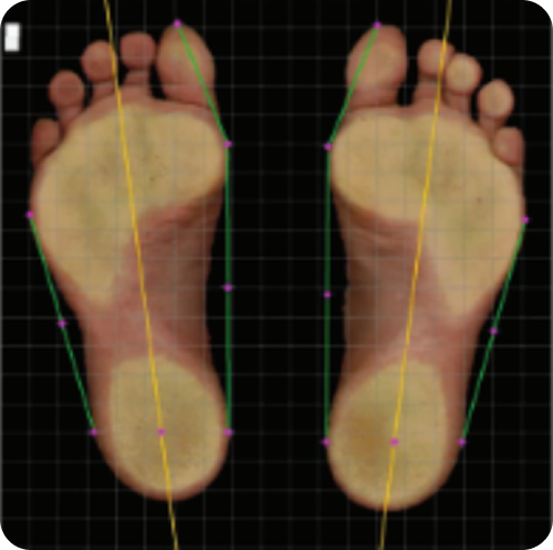 Rotación de Superficie